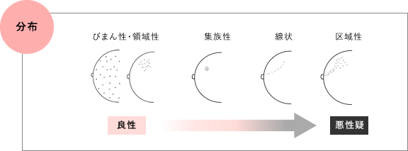 分布